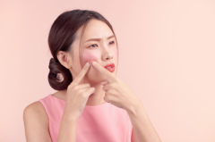 脸上痘痘怎么改善